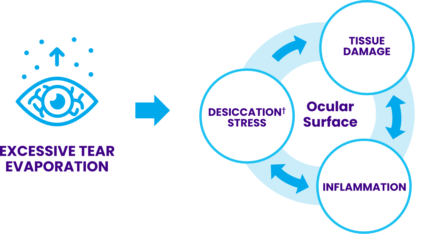 Cycle of dry eye disease illustration